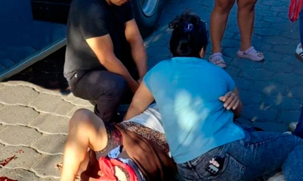 Doctores logran reconstruir pierna de señora atropellada por bus en Managua